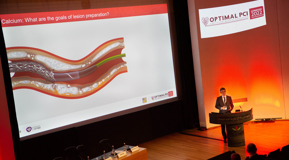 Optima - calcium is a critical factor in stent expansion